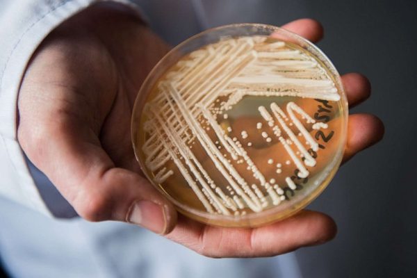 The Reasons behind Health Departments' Concerns about the Spread of Potentially Fatal Fungus