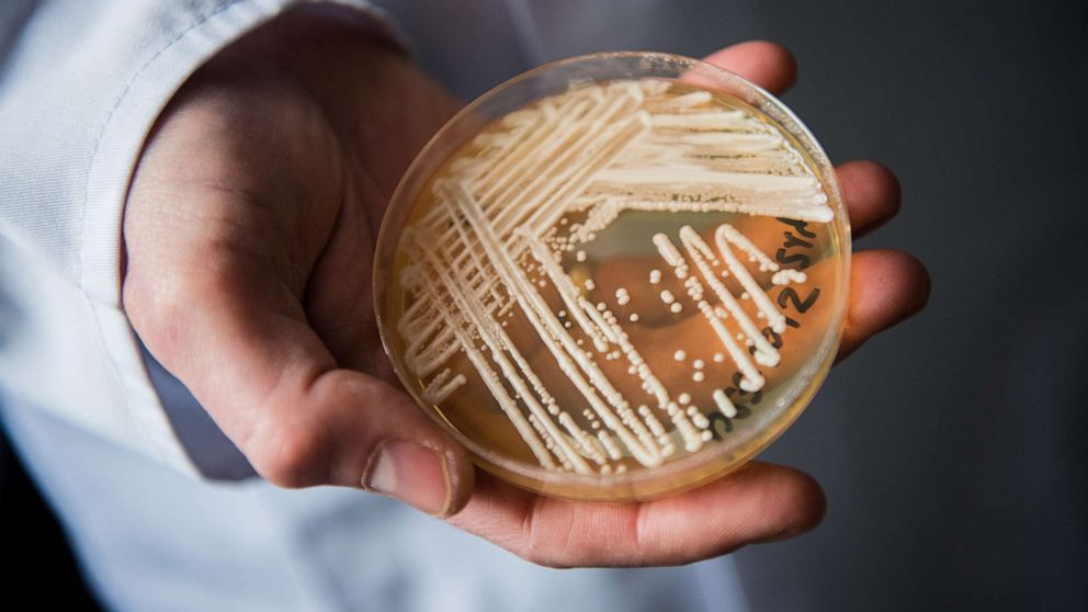 The Reasons behind Health Departments' Concerns about the Spread of Potentially Fatal Fungus