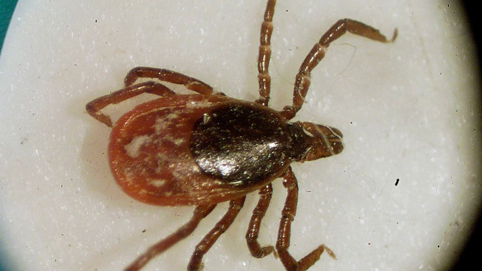 How to Prevent Hungry Ticks from Landing on You and Your Pets Using a Static Trick