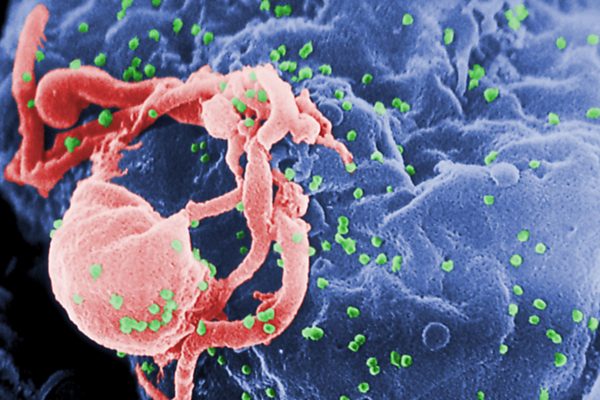 Study finds that 4 children achieve over a year of HIV remission following treatment pause