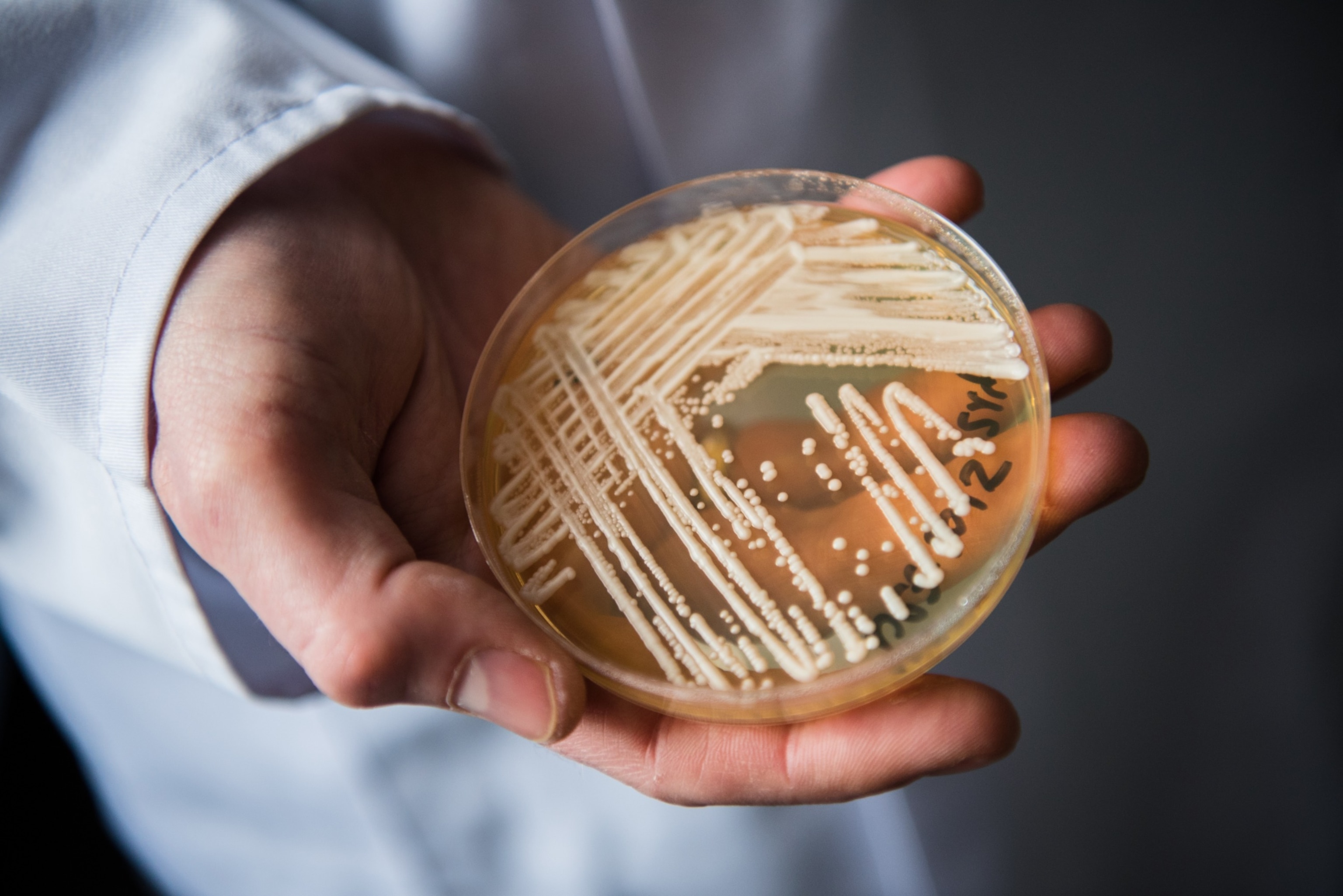 PHOTO: The director of the National Reference Centre for Invasive Fungus Infections, Oliver Kurzai, holding in his hands a petri dish holding the yeast candida auris in a laboratory of Wuerzburg University in Wuerzburg, Germany, January 23, 2018.