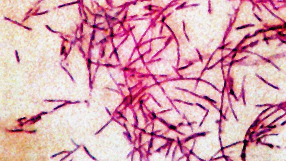 Health Officials Report 5 Cases of Legionnaires' Disease in New Hampshire