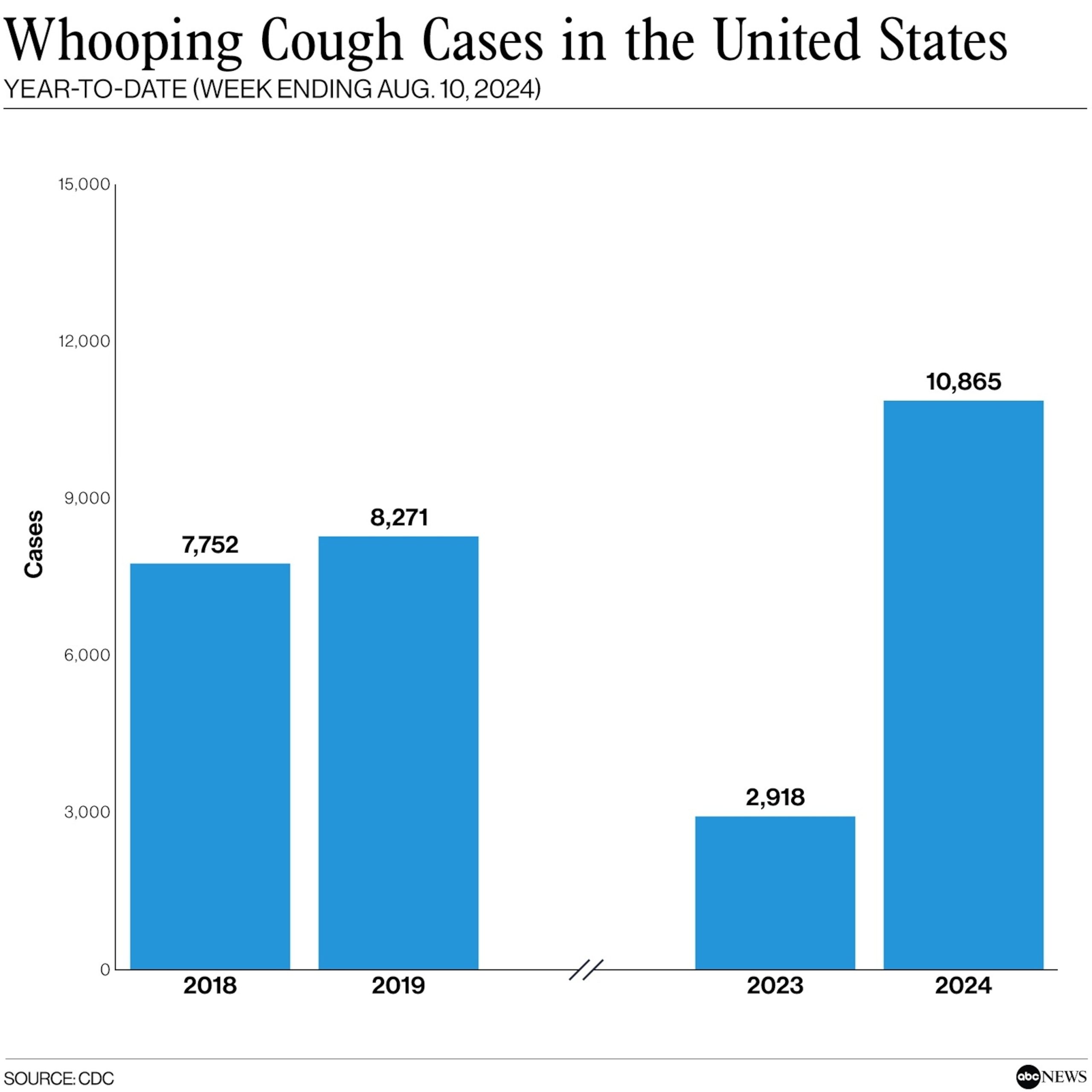 Significant Increase in Whooping Cough Cases Compared to Last Year, Reaching Pre-Pandemic Levels